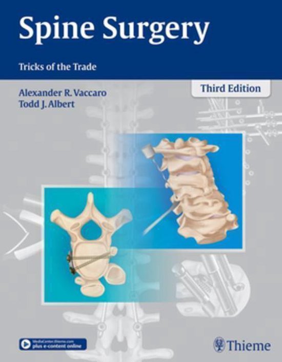 Spine Surgery
