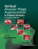 Vertical Augmentation Alveolar Ridge