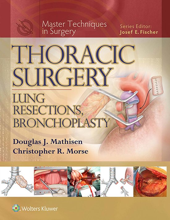 Master Techniques in Surgery - Thoracic Surgery: Lung Resect ... - cover