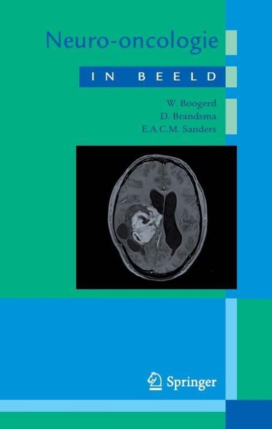 Neuro-oncologie in beeld - cover