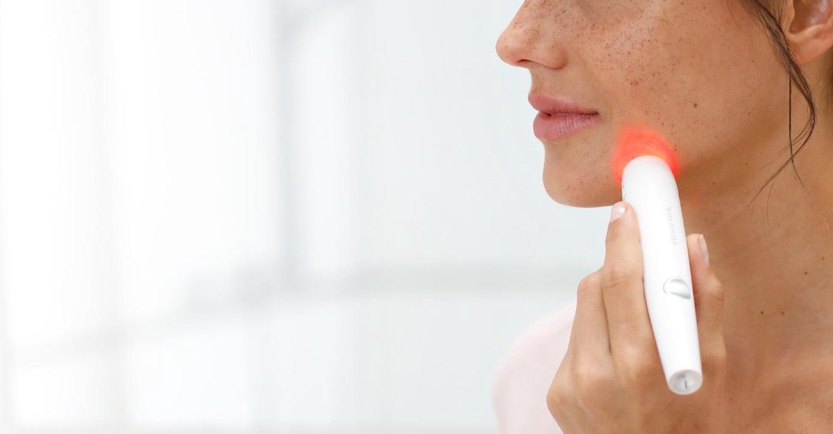 Medisana - DC 300 LED-lichttherapie-  acne-puistjes-pukkels-gezichtsbehandeling-... | bol.com