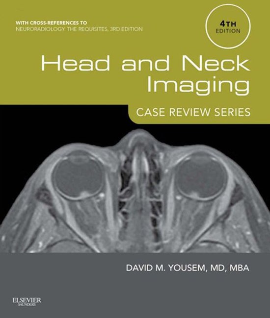 Case Review - Head and Neck Imaging: Case Review Series E-Bo ... - cover