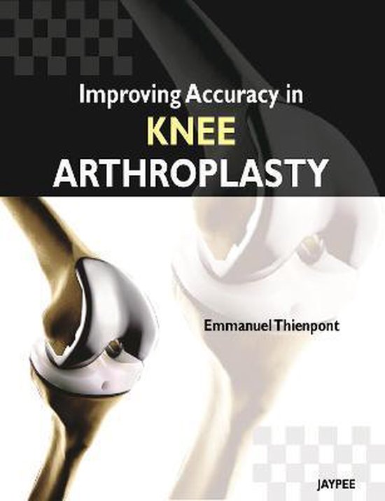 Improving Accuracy In Knee Arthroplasty 9789350258705 Emmanuel