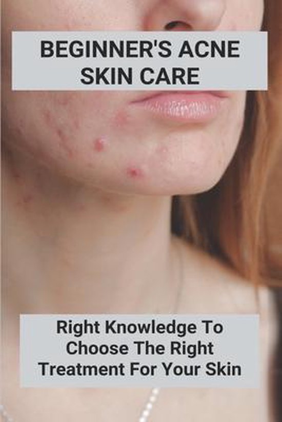 Beginner's Acne Skin Care - cover