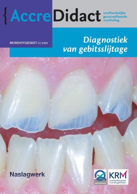 AccreDidact MH2021-1 - Diagnostiek van gebitsslijtage