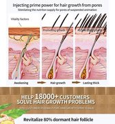 haargroei spray - hair grow spray