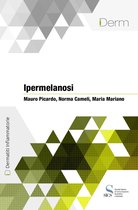 Ipermelanosi