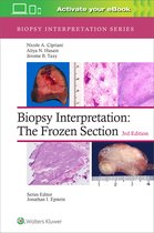 Biopsy Interpretation Series- Biopsy Interpretation: The Frozen Section: Print + eBook with Multimedia