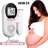 Allernieuwste.nl® Baby Doppler Hartslagmeter Versie 2.0 Baby Hartje Monitor - Zwangerschap LCD Hartslag Meter - Ultrasound Incl Gel - Zwanger Rose