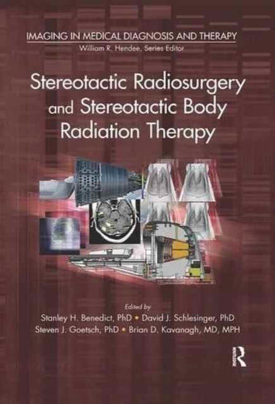 13934369042019981912alleepub Stereotactic Body Radiation Therapy Principles And Practiceshtml