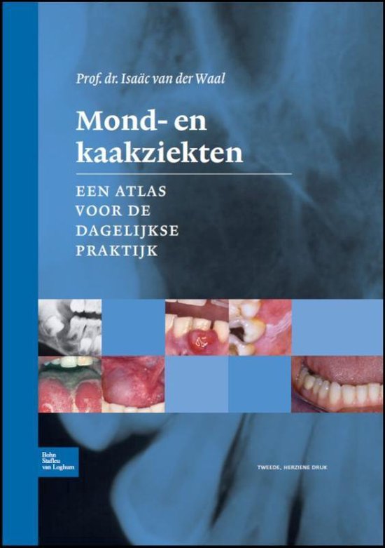 Cover van het boek 'Mond- en kaakziekten / druk 2'