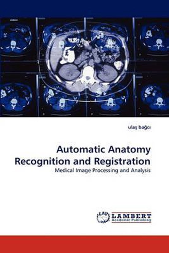 Automatic Anatomy Recognition and Registration | 9783838380148 ...