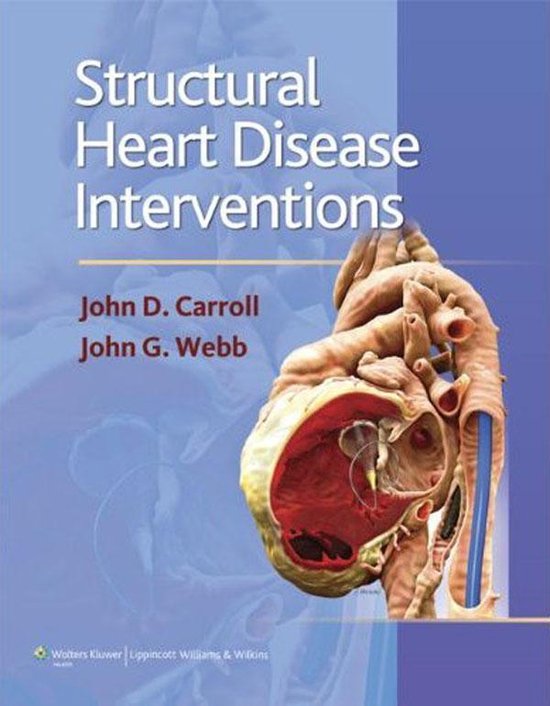 Structural Heart Disease Interventions (ebook), John D. Carroll ...