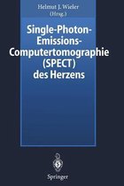 Single-Photon-Emissions-Computertomographie (Spect) Des Herzens