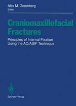 Craniomaxillofacial Fractures