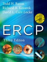 ERCP