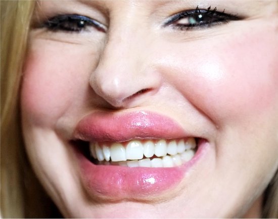 Foto: 