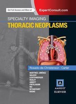 Specialty Imaging - Specialty Imaging: Thoracic Neoplasms E-Book