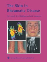 The Skin in Rheumatic Disease