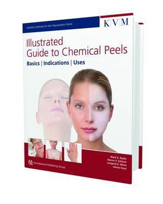 Illustrated Guide to Chemical Peels