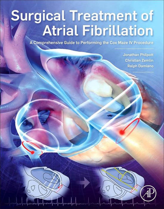 Surgical Treatment of Atrial Fibrillation - cover