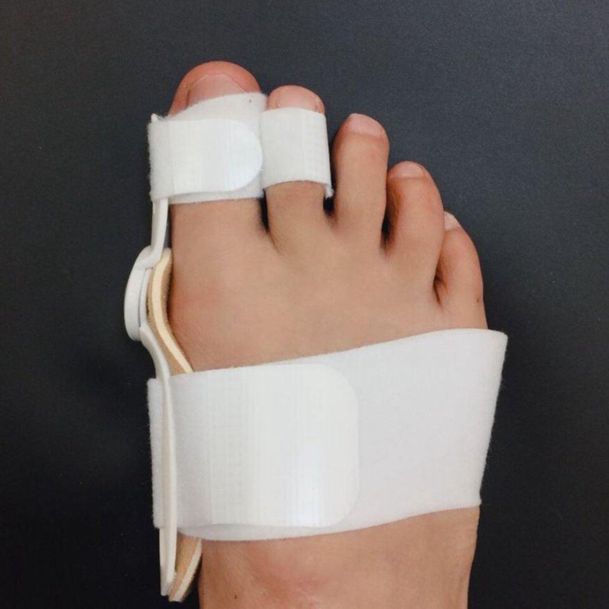 Goedkoopste New Age Devi 1 stks Grote Bot Teen Bunion Spalk Stijltang Corrector Voetverzorging Pijnbestrijding Hallux Valgus Orthopedische Benodigdheden Pedicure Tool