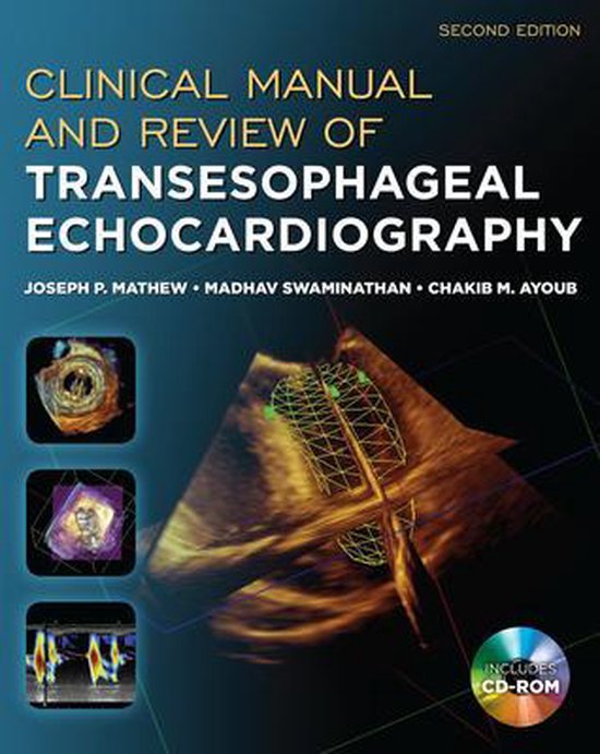 Clinical Manual and Review of Transesophageal Echocardiograp ... - cover