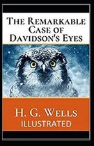 The Remarkable Case of Davidsons Eyes Illustrated