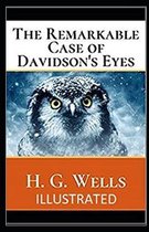 The Remarkable Case of Davidsons Eyes Illustrated