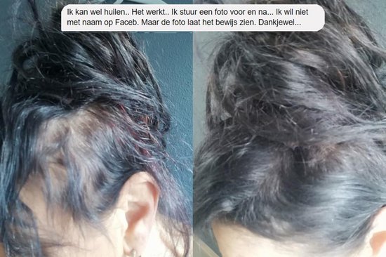 Vóór en na foto's van vrouwelijk haar, waarbij IMPERIO haarvezels dunner wordend haar camoufleren.