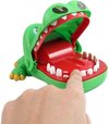 Afbeelding van het spelletje Spel Bijtende Krokodil – Krokodil met Kiespijn – Krokodil Tanden Spel - Tandarts - Reisspel - Party Spel - Gezelschapsspel - Drankspel - Shot spel - Groene Krokodil