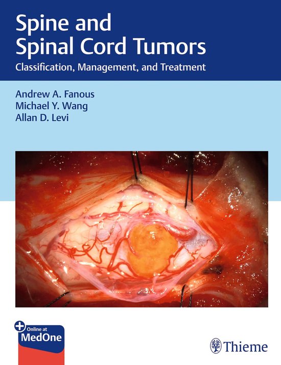 Spine and Spinal Cord Tumors - cover