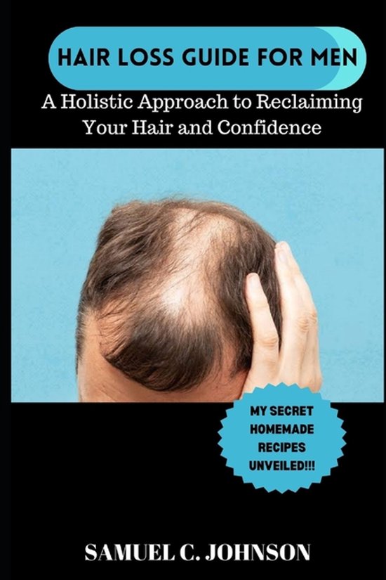 Hairloss Guide for Men - cover