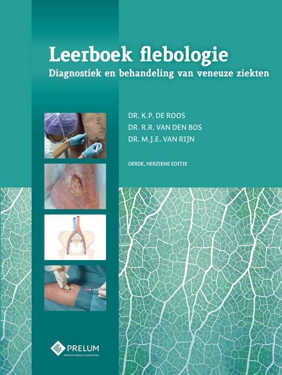 Leerboek flebologie - cover
