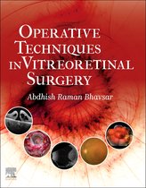 Operative Techniques in Vitreoretinal Surgery