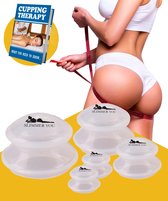 Slimmer You Cellulite Cups - Cupping Set - Cupping Cups - Cellulite Massage Apparaat + extra facial cup!