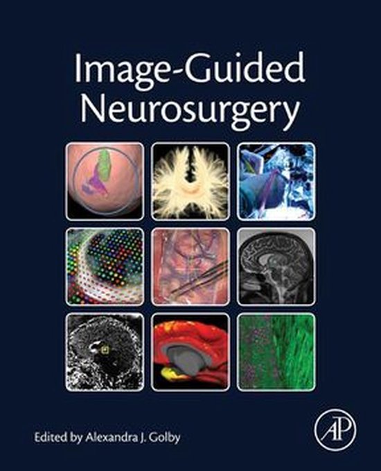 Image-Guided Neurosurgery - cover