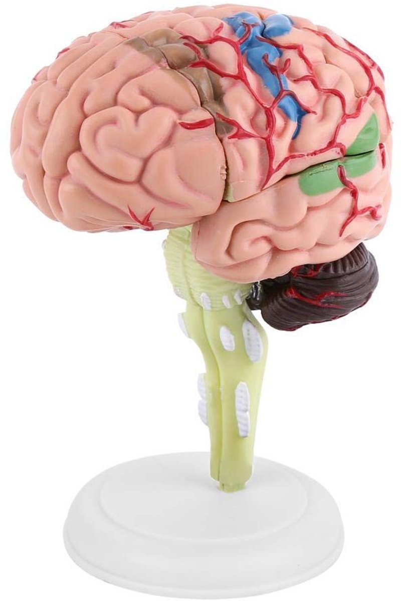 ONF3 - Menselijk Anatomisch Breinmodel - Educatief Plastic Model - Ideaal voor onderwijs - Realistische weergave - Anatomie en biologie - Geschi...