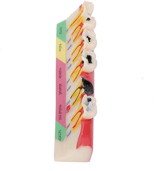 Tandbederf Model - Tand Anatomie - Onderwijs & Demonstratie - Gedetailleerde Structuren - 15 x 4 x 4 cm - Kleurrijk — afbeelding 4