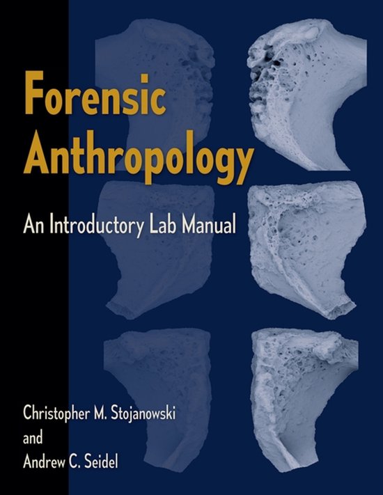 Forensic Anthropology - cover
