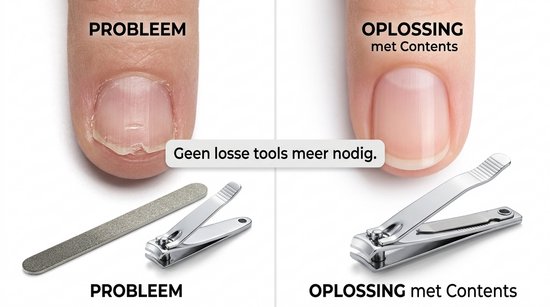 Pince à ongles grand modèle - Avec lime - Métal