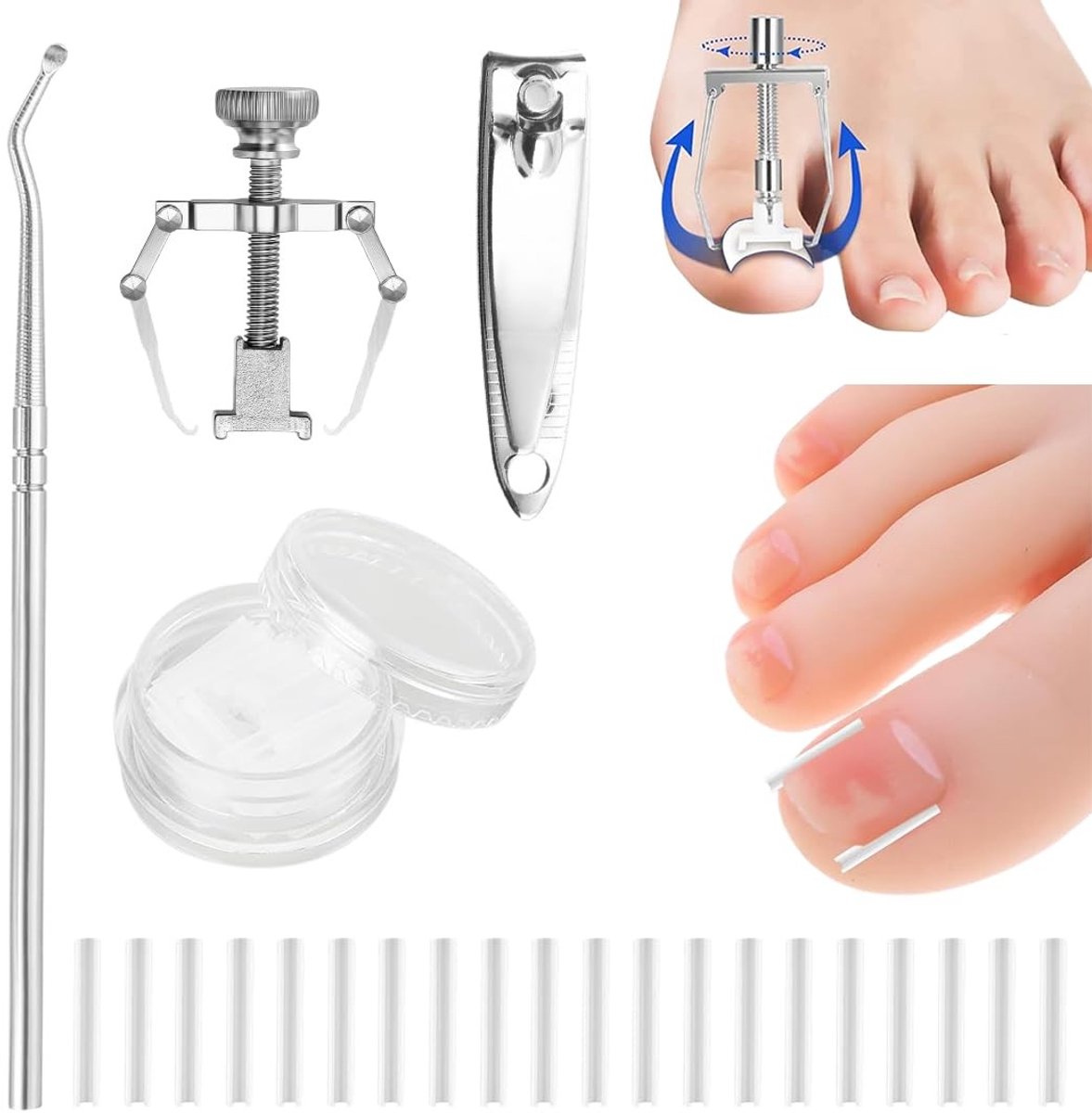 Dailygoods- Teennagelcorrectieset 50 Stuks - Pijnvrije Teennagelstraps - Ingroeiteennagelcorrectie - Teennagelliftingstick - Behandeling Ingroeiteennagel - Schokbestendig en Duurzaam - Teennagelcorrectie