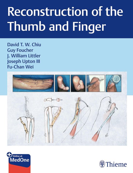 Reconstruction of the Thumb and Finger - cover