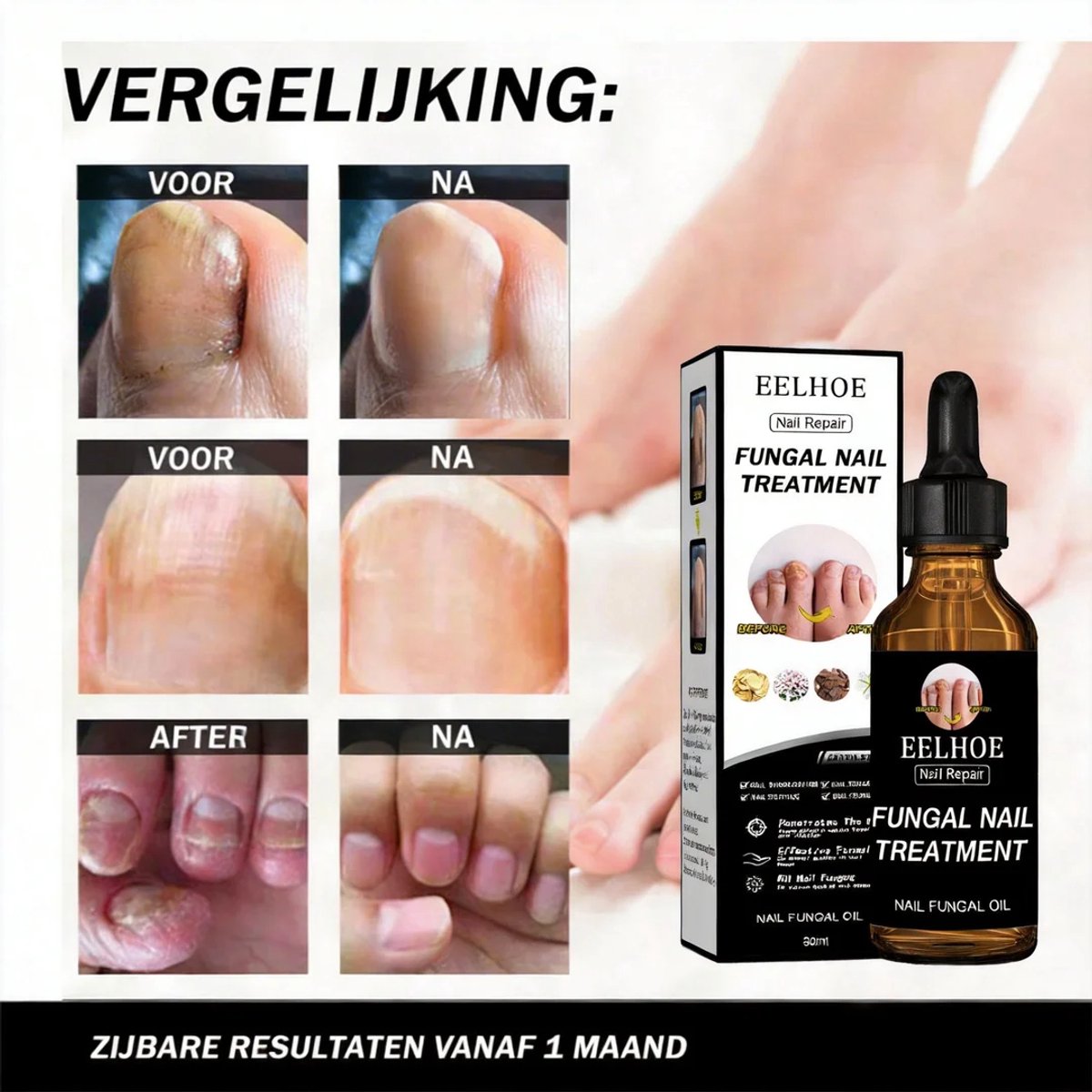 EELHOE Nagelherstelvloeistof – Nagelverzorging – Versterkt – Verlicht – Hydrateert – Herstelt Broze Nagels – Tegen Verkleuring – Verstevigt Nageloppervlak – Voedt Nagel & Nagelriem