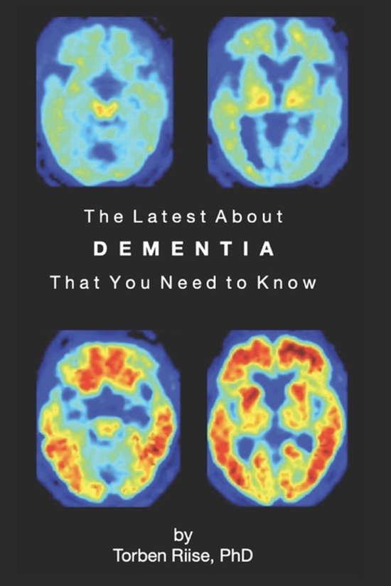 The Latest About Dementia - cover