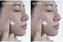 Vrouwenhand brengt witte crème aan op gezicht. 'Before' en 'After' foto's.