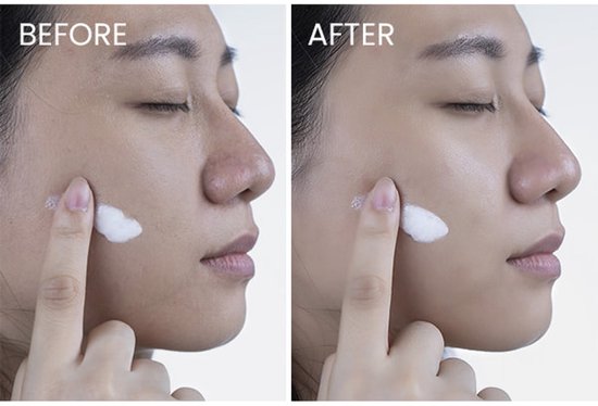 Vrouwenhand brengt witte crème aan op gezicht. 'Before' en 'After' foto's.
