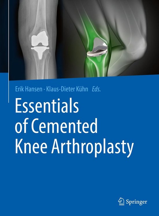 Medicine (R0) - Essentials of Cemented Knee Arthroplasty - cover