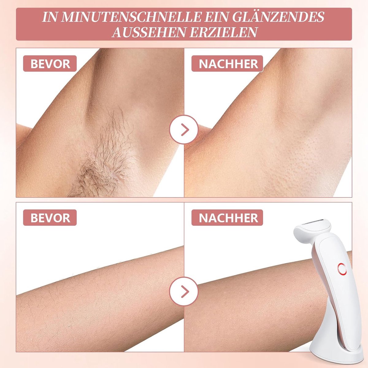 Scheerapparaat 3-in-1 Elektrisch Dames Scheerapparaat met - afbeelding 3