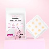 Glam and Go - microneedle pimple patches - micronaalden puitjes patches - microneedle acne patch